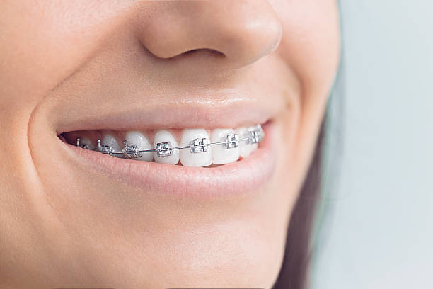 Best Dental X-Rays and Imaging  in Bremerton, WA